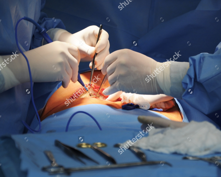 Gynécologie opératoire, genève gynéco